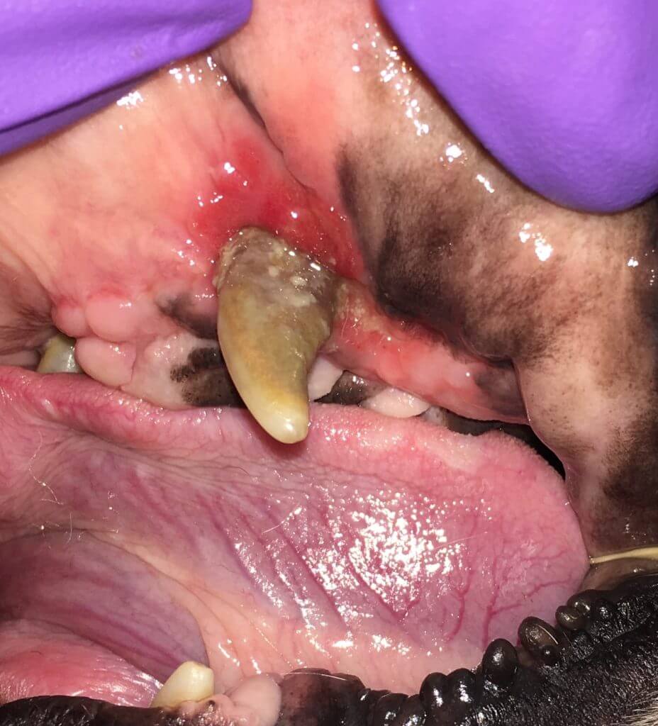oral nasul fistulas
